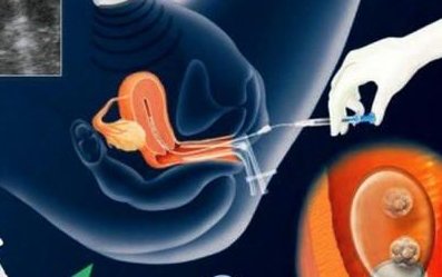 上海妇幼医院排行榜名单公布，第五人民院闯入前十名