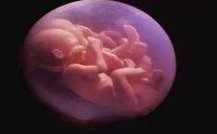 试管婴儿在马来西亚的费用分析：一次治疗的价格曝光！